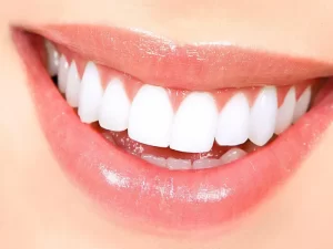 اصلاح طرح لبخند