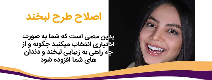 اصلاح طرح لبخند زیبا