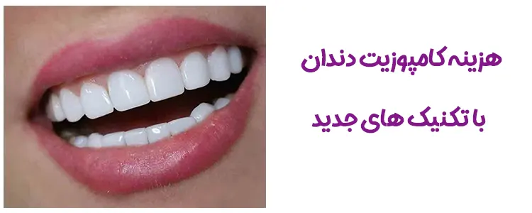 قیمت کامپوزیت دندان