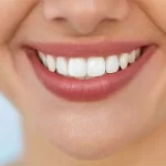 مراقبت های پس از کامپوزیت