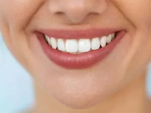 مراقبت های پس از کامپوزیت