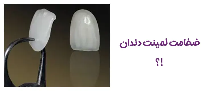ضخامت لمینت دندان