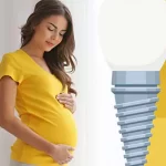 ایمپلنت دندان در بارداری