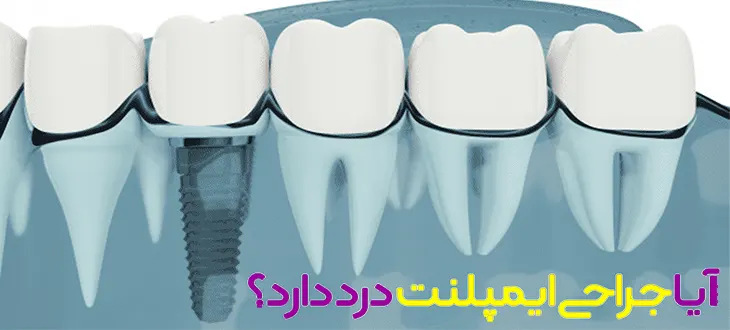 درد جراحی ایمپلنت