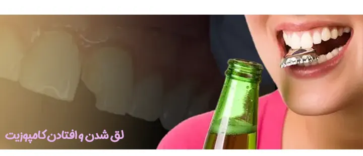 لق شدن و افتادن کامپوزیت