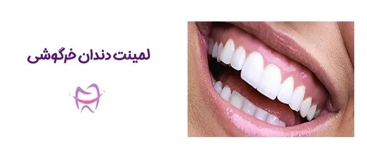 لمینت دندان های خرگوشی