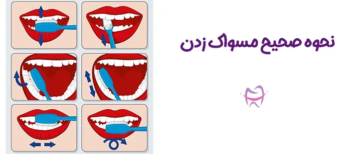نحوه صحیح مسواک زدن بزرگسالان