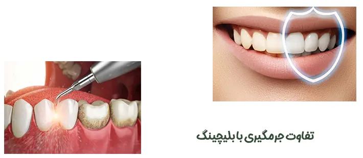 تفاوت جرمگیری با بلیچینگ
