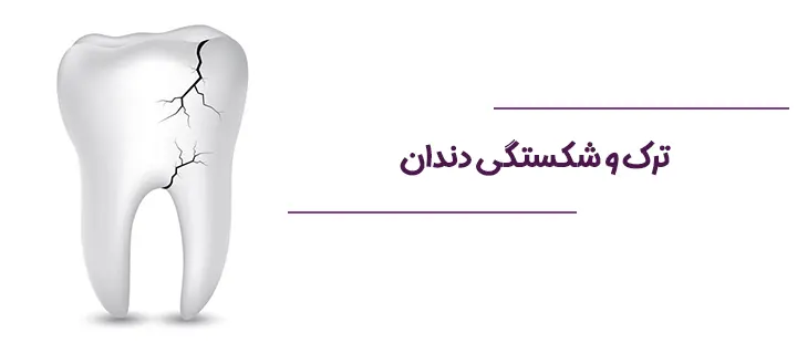 ترک و شکستگی دندان