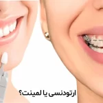 ارتودنسی یا کامپوزیت