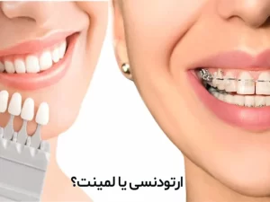 ارتودنسی یا کامپوزیت