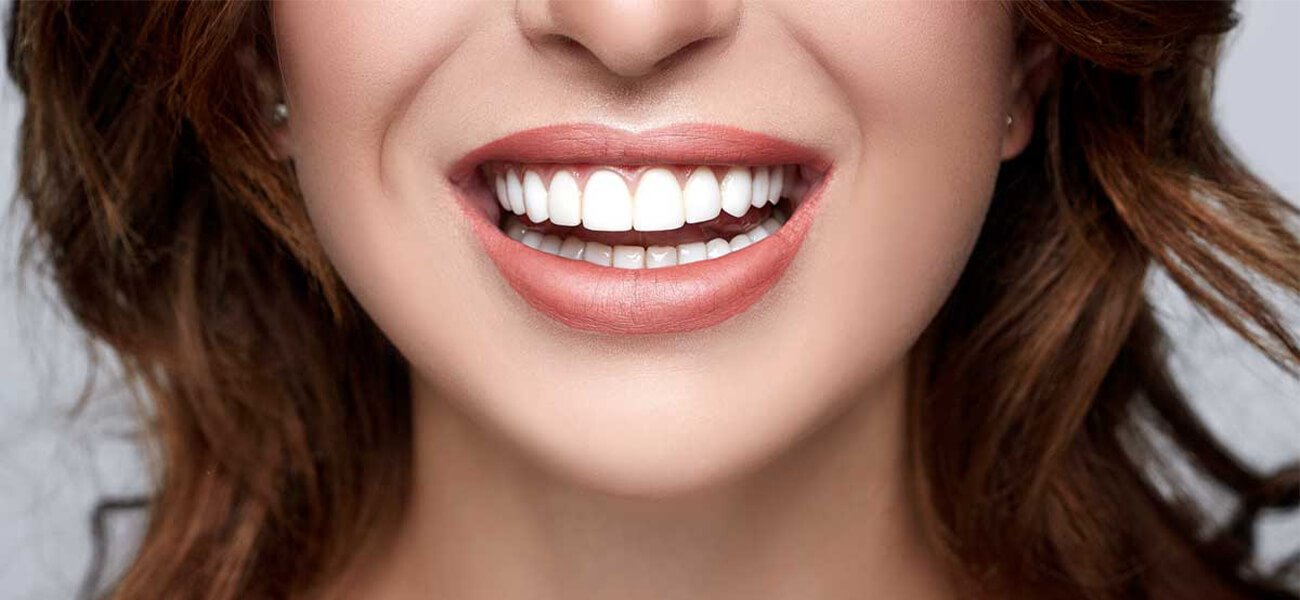طراحی لبخند چیست ؟