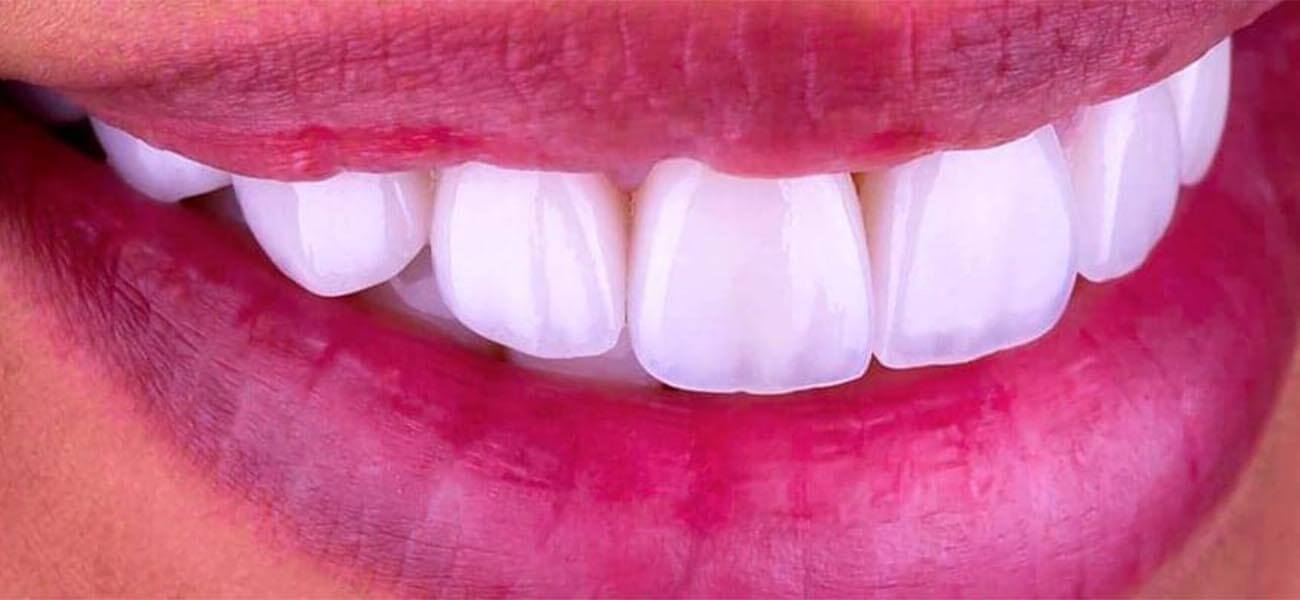 بهترین مرکز کامپوزیت ونیر در جردن کجاست؟